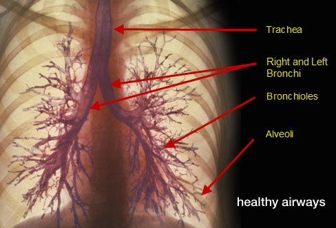 copd-healthy-airways